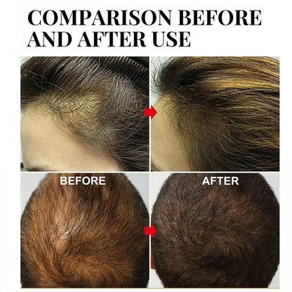 Olio Ricrescita Rosmarino